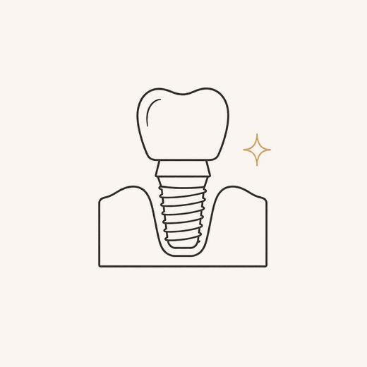 Dental implants