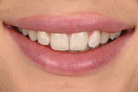 Case 16 before